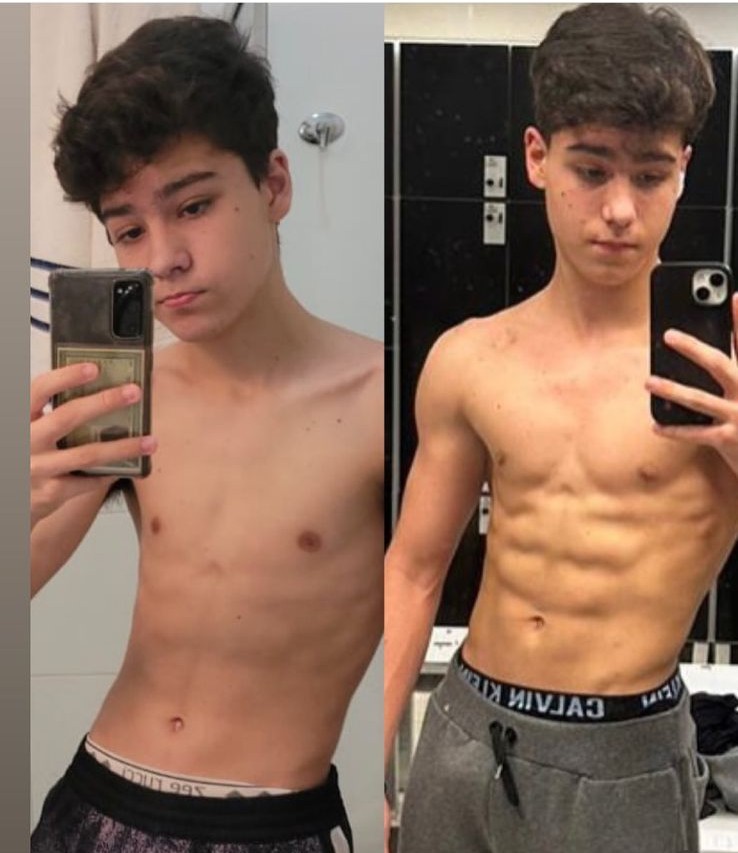 Antes e depois aluno 1